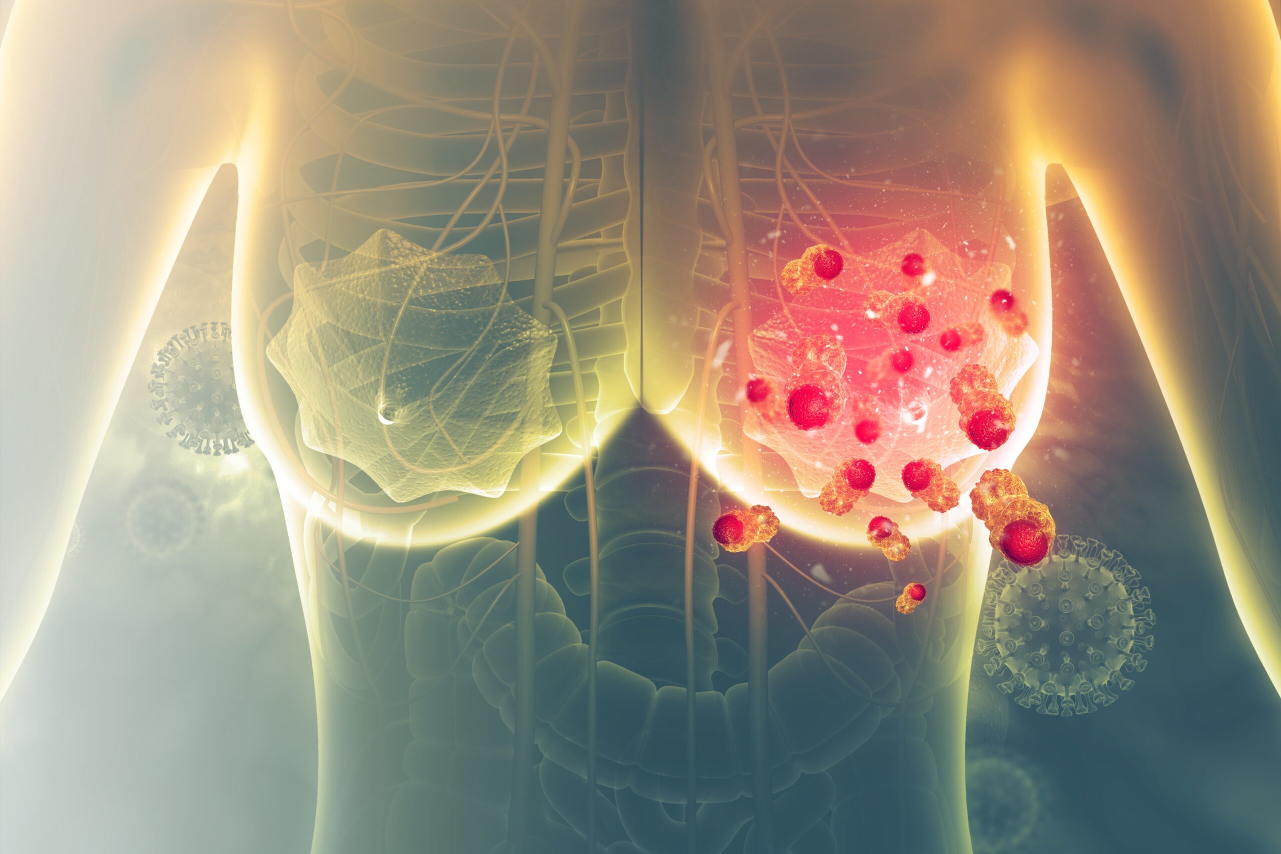 健康・医学 Breast Cancer Pembrolizumab plus chemotherapy in advanced triple-negative
