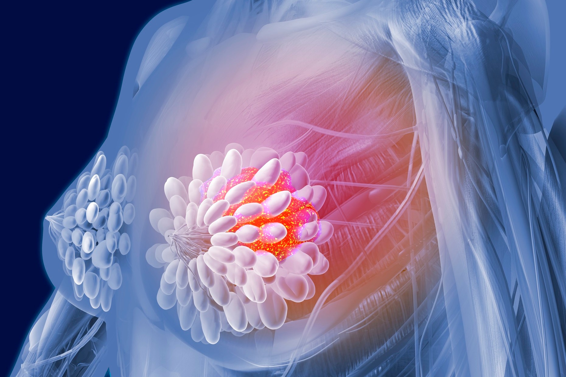 Emilycc Cancer
